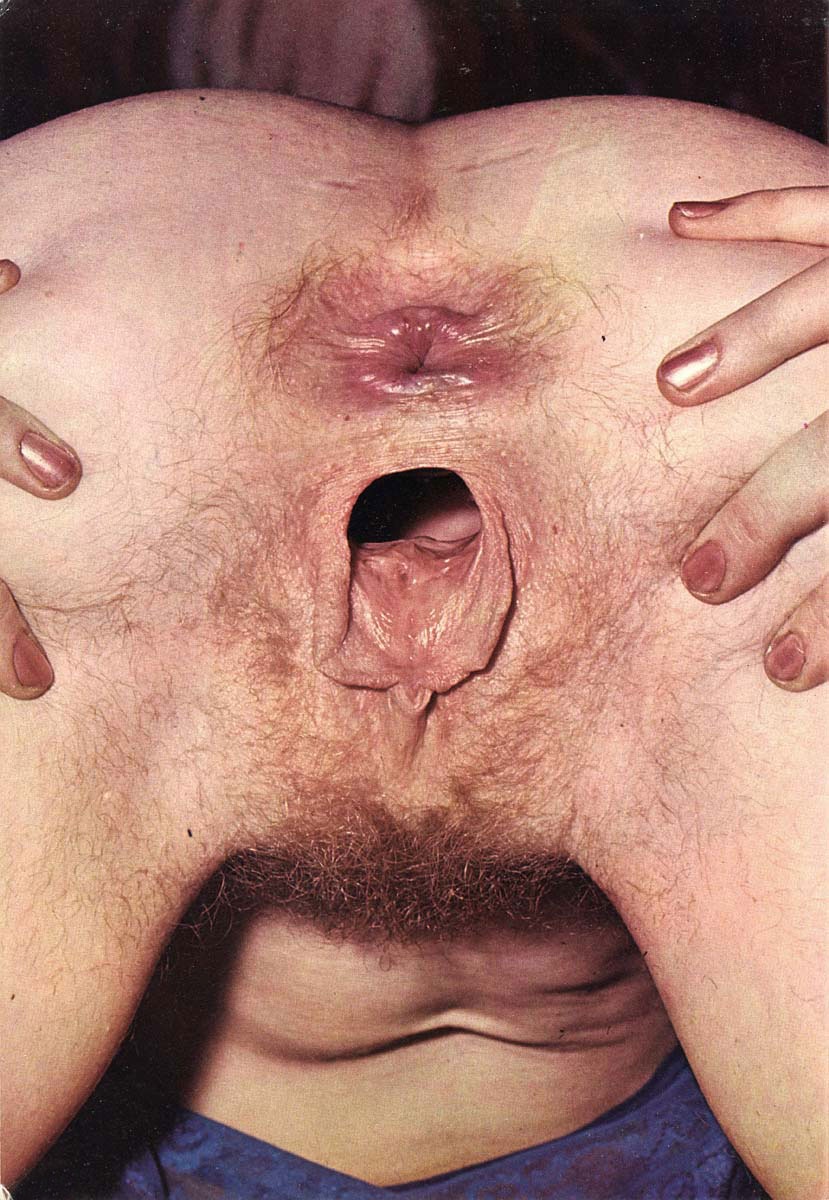 Порно уродство половых органов (60 фото) - порно grantafl.ru