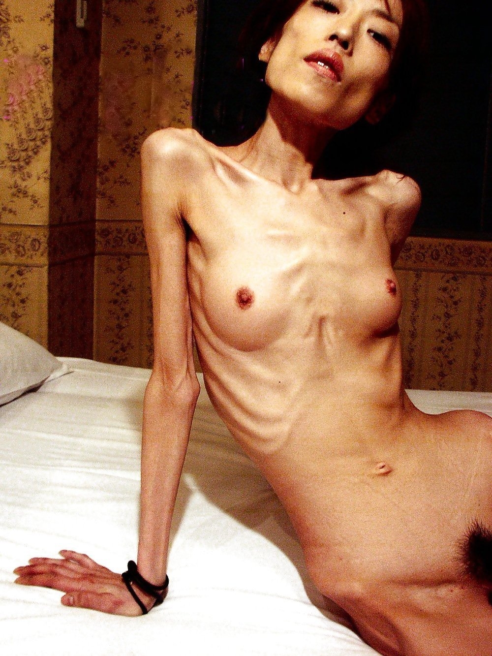 Голые девушки с анорексией - порно фото поддоноптом.рф